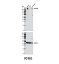 VEGF Receptor 2 (D5B1) Rabbit mAb