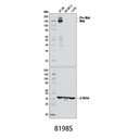 Met (D1C2) XP Rabbit mAb