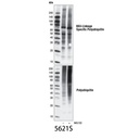 K63-linkage Specific Polyubiquitin (D7A11) Rabbit mAb