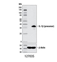 IL-1β (D3U3E) Rabbit mAb