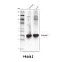 Arginase-1 (D4E3M) XP Rabbit mAb