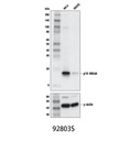 p16 INK4A (D3W8G) Rabbit mAb