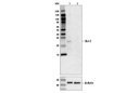 Bcl-2 (D55G8) Rabbit mAb (Human Specific)