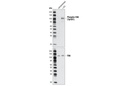 Phospho-FAK (Tyr397) Antibody