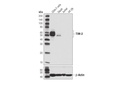 TIM-3 (D5D5R) XP Rabbit mAb
