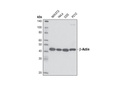 β-Actin (13E5) Rabbit mAb (HRP Conjugate)