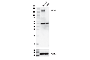 CD163 (D6U1J) Rabbit mAb