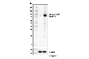 Cleaved PARP (Asp214) (D6X6X) Rabbit mAb (Rodent Specific)