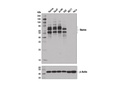 Ikaros (D6N9Y) Rabbit mAb