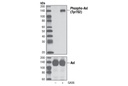 Phospho-Axl (Tyr702) (D12B2) Rabbit mAb