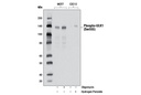 Phospho-ULK1 (Ser555) (D1H4) Rabbit mAb