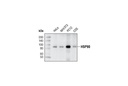 HSP90 (C45G5) Rabbit mAb