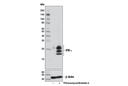 IFN-γ (D3H2) XP Rabbit mAb