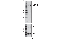 Phospho-Jak1 (Tyr1034/1035)/Jak2 (Tyr1007/1008) (E9Y7V) Mouse mAb