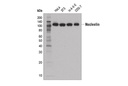 Nucleolin (D4C7O) Rabbit mAb
