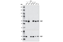 Akt2 (D6G4) Rabbit mAb