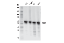 PTBP1 (E4I3Q) Rabbit mAb