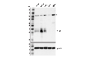 CTGF (D8Z8U) Rabbit mAb