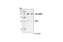 Bad Antibody