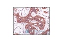 Phospho-Akt (Ser473) (736E11) Rabbit mAb