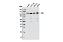 FAK (D2R2E) Rabbit mAb