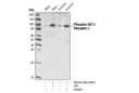Phospho-IGF-I Receptor β (Tyr1135/1136)/Insulin Receptor β (Tyr1150/1151) (19H7) Rabbit mAb
