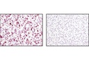 TRA-1-81 (TRA-1-81) Mouse mAb