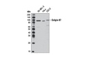 Golgin-97 (D8P2K) Rabbit mAb