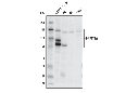DNMT3A (E9P2F) Rabbit mAb