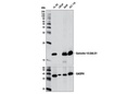 Galectin-1/LGALS1 (D608T) Rabbit mAb