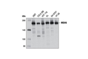 MSH6 (3E1) Mouse mAb
