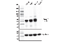 FoxA1/HNF3α (E7E8W) Rabbit mAb