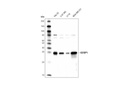 IGFBP1 (D4E9T) XP Rabbit mAb