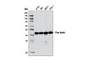 Pan-Actin (D18C11) Rabbit mAb