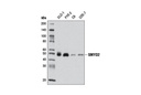 SMYD2 (D14H7) Rabbit mAb