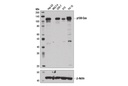 p130 Cas (E1L9H) Rabbit mAb