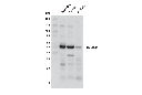 HMGCS2 (D3U1A) Rabbit mAb
