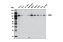 PKD2 (D1A7) Rabbit mAb