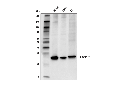 SIGMAR1 (D4J2E) Rabbit mAb