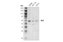 NLK (D9X3C) Rabbit mAb