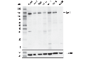 Jak1 (E3A6M) Rabbit mAb