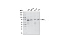 PKCζ (C24E6) Rabbit mAb