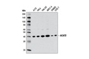 ACAT2 (E1L8V) Rabbit mAb