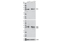 Stat3α (D1A5) XP Rabbit mAb