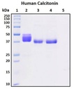 Recombinant Human Calcitonin (CT)