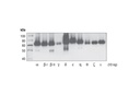 Phospho-PKC (pan) (zeta Thr410) (190D10) Rabbit mAb
