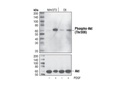 Phospho-Akt (Thr308) (L32A4) Mouse mAb