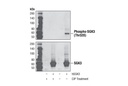Phospho-SGK3 (Thr320) (D30E6) Rabbit mAb