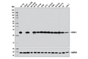 UCHL1 (D3T2E) XP Rabbit mAb