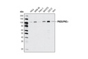 PKD3/PKCν (D57E6) Rabbit mAb